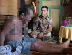 Ketua DPRK Banda Aceh Besuk Warga Penderita Autoimun Di Gampong Keuramat.